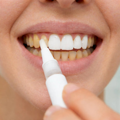 Whitening pen