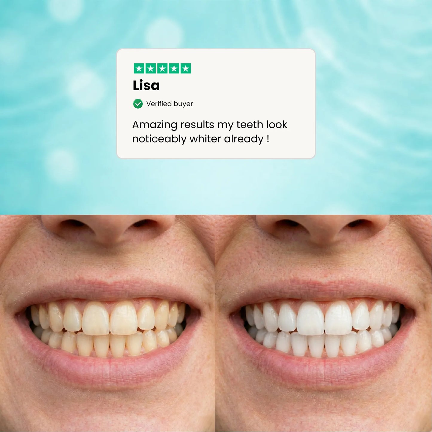 Whitening pen