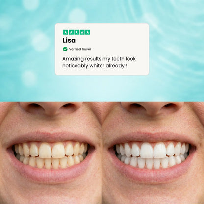 Whitening toothpaste